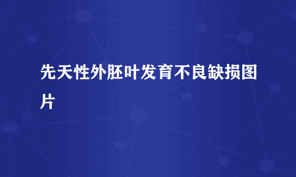 先天性外胚叶发育不良缺损图片