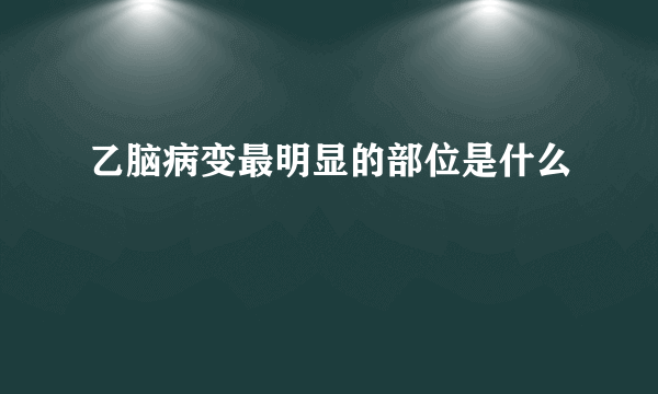 乙脑病变最明显的部位是什么