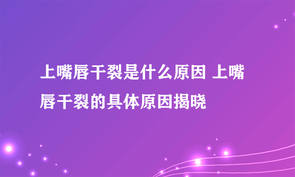 上嘴唇干裂是什么原因 上嘴唇干裂的具体原因揭晓