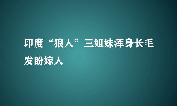 印度“狼人”三姐妹浑身长毛发盼嫁人