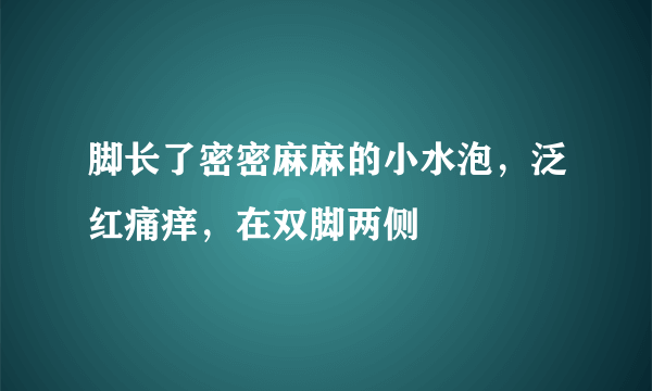 脚长了密密麻麻的小水泡，泛红痛痒，在双脚两侧