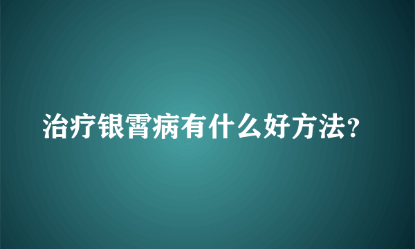 治疗银霄病有什么好方法？