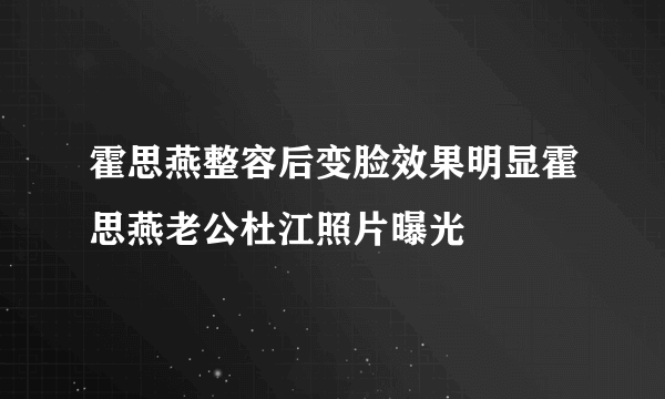 霍思燕整容后变脸效果明显霍思燕老公杜江照片曝光