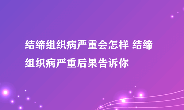 结缔组织病严重会怎样 结缔组织病严重后果告诉你