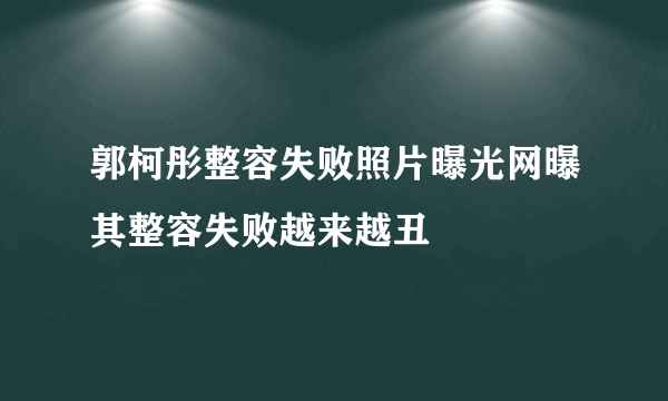 郭柯彤整容失败照片曝光网曝其整容失败越来越丑