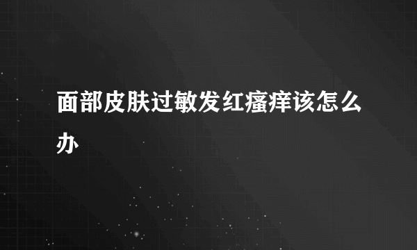 面部皮肤过敏发红瘙痒该怎么办