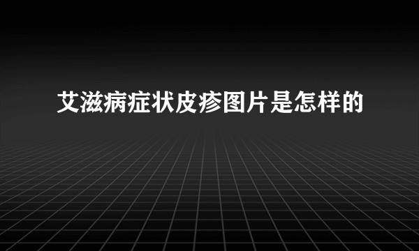 艾滋病症状皮疹图片是怎样的