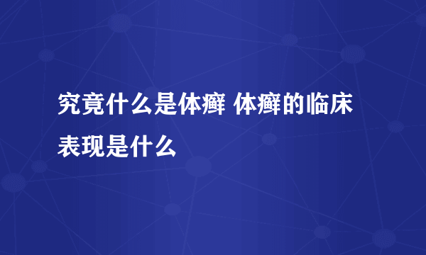 究竟什么是体癣 体癣的临床表现是什么