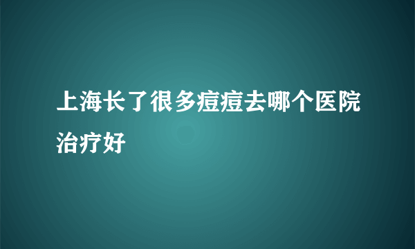 上海长了很多痘痘去哪个医院治疗好