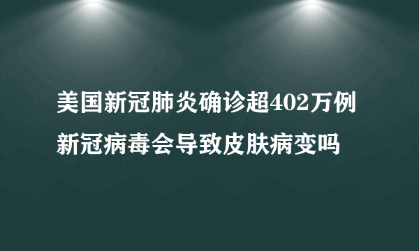 美国新冠肺炎确诊超402万例 新冠病毒会导致皮肤病变吗