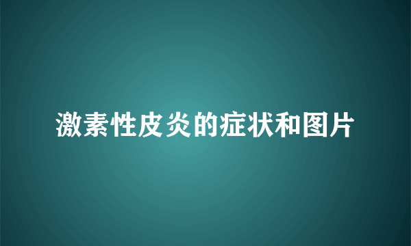 激素性皮炎的症状和图片