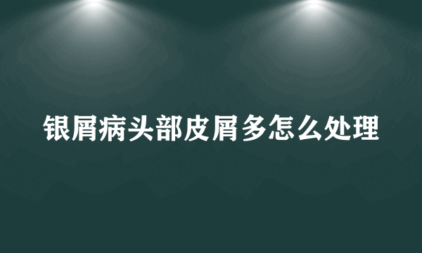 银屑病头部皮屑多怎么处理