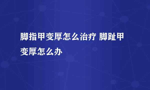 脚指甲变厚怎么治疗 脚趾甲变厚怎么办