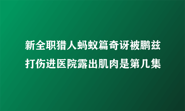 新全职猎人蚂蚁篇奇讶被鹏兹打伤进医院露出肌肉是第几集