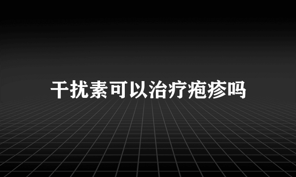 干扰素可以治疗疱疹吗