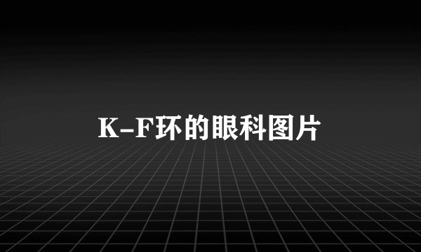 K-F环的眼科图片