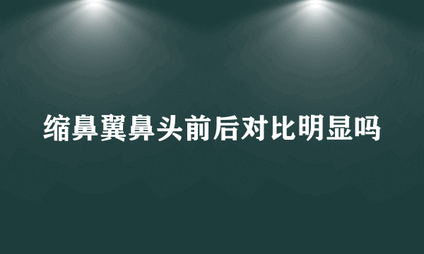 缩鼻翼鼻头前后对比明显吗