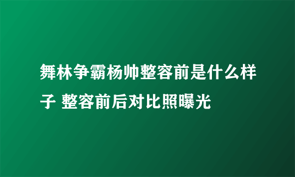 舞林争霸杨帅整容前是什么样子 整容前后对比照曝光