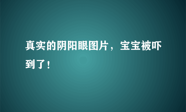 真实的阴阳眼图片，宝宝被吓到了！