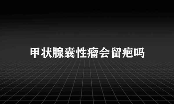 甲状腺囊性瘤会留疤吗