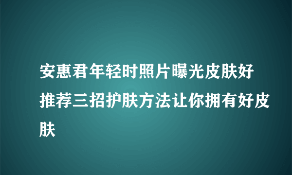 安惠君年轻时照片曝光皮肤好推荐三招护肤方法让你拥有好皮肤